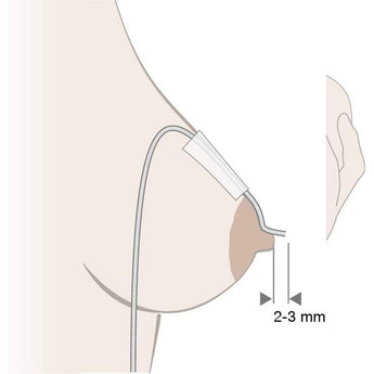 Medela - Supplemental Nursing System