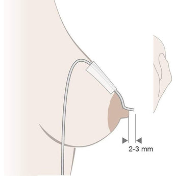 Medela - Supplemental Nursing System