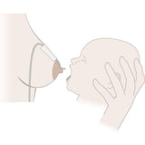 Medela - Supplemental Nursing System