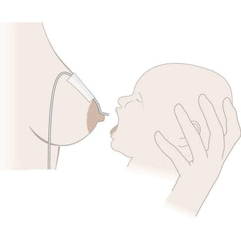 Medela - Supplemental Nursing System