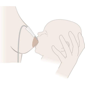 Medela - Supplemental Nursing System